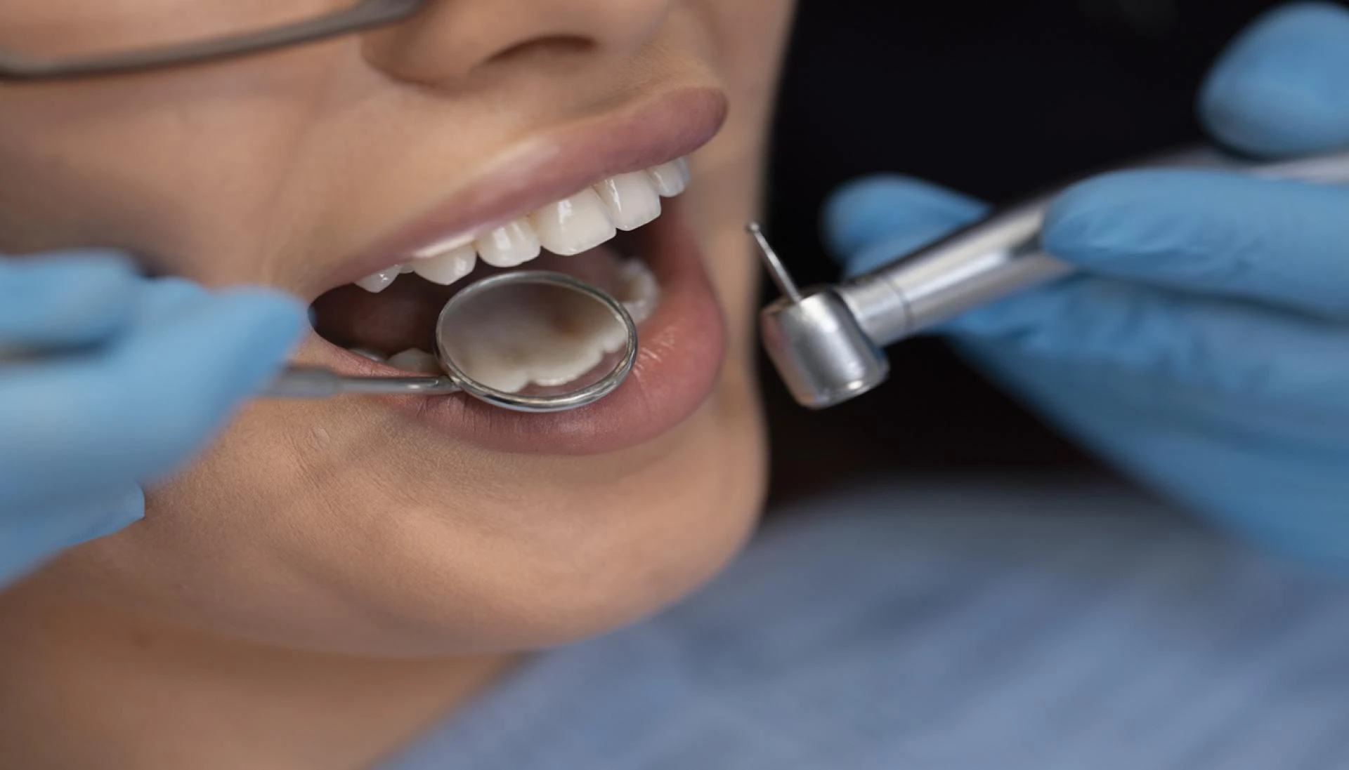 Understanding Your Options for Tooth Replacement in Mundelein
