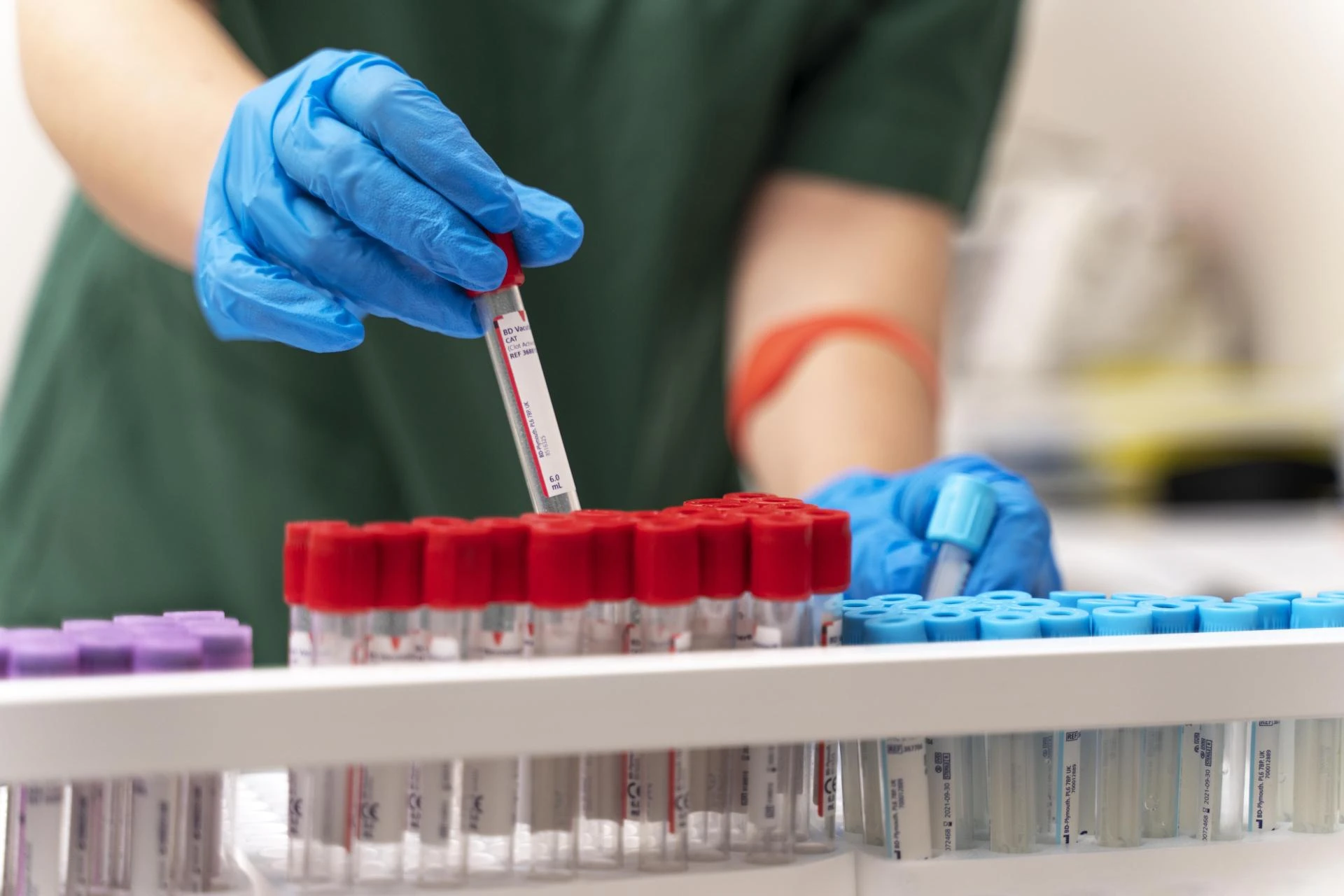 Kidney Function Test: Understanding Your Kidney Health