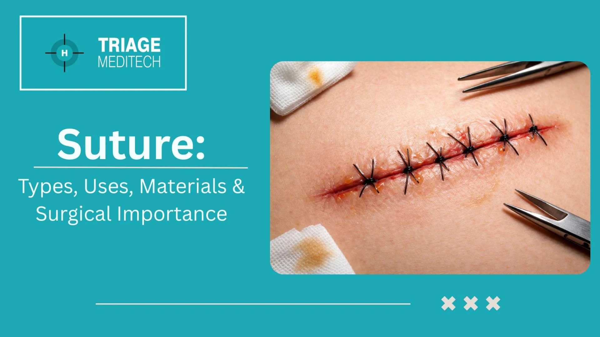 Suture: Types, Uses, Materials & Surgical Importance