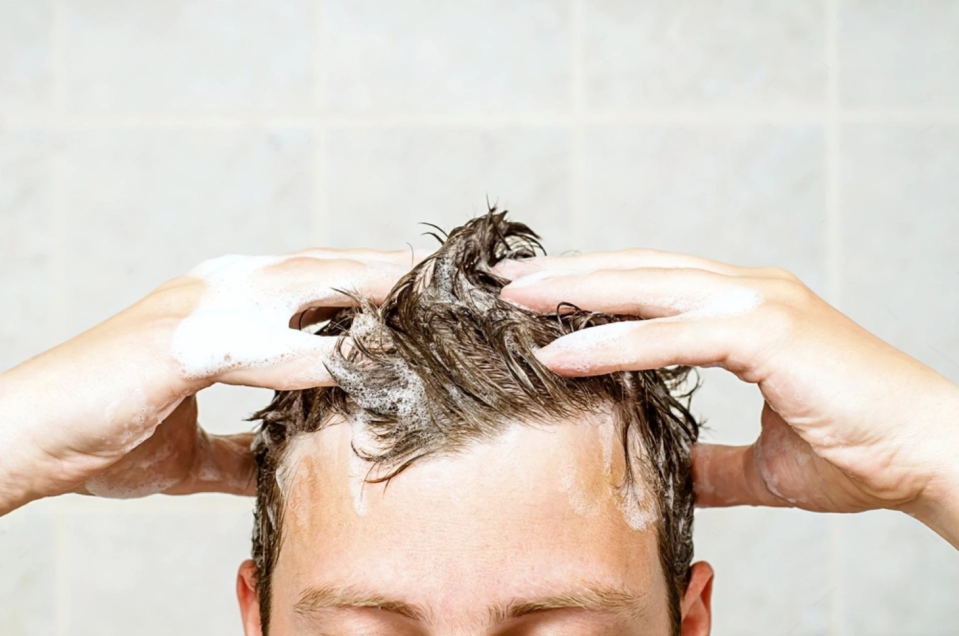Clear Scalp, Confident You: A Practical Guide to Beating Persistent Dandruff