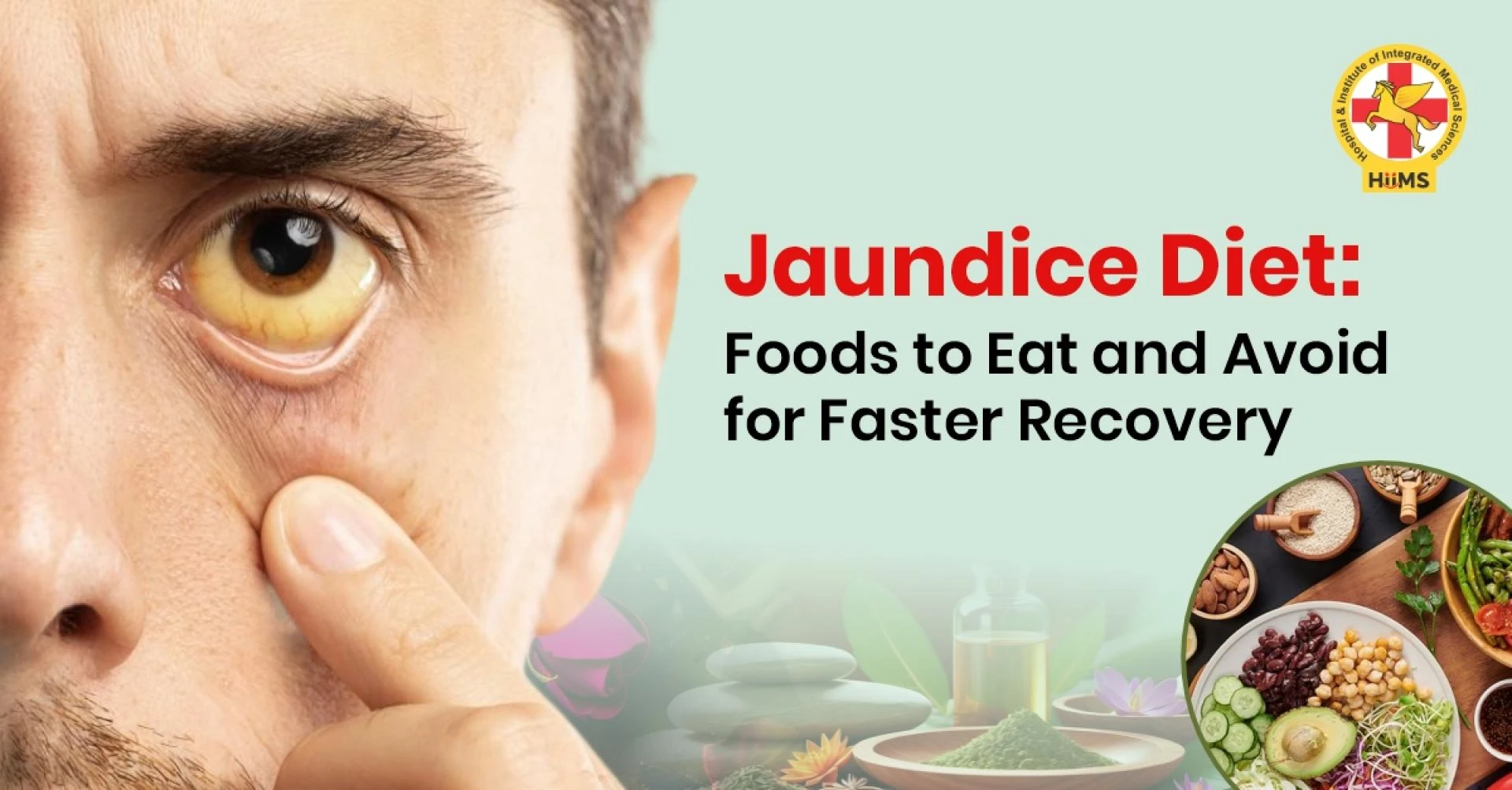 Jaundice Diet: Foods to Eat and Avoid for Faster Recovery