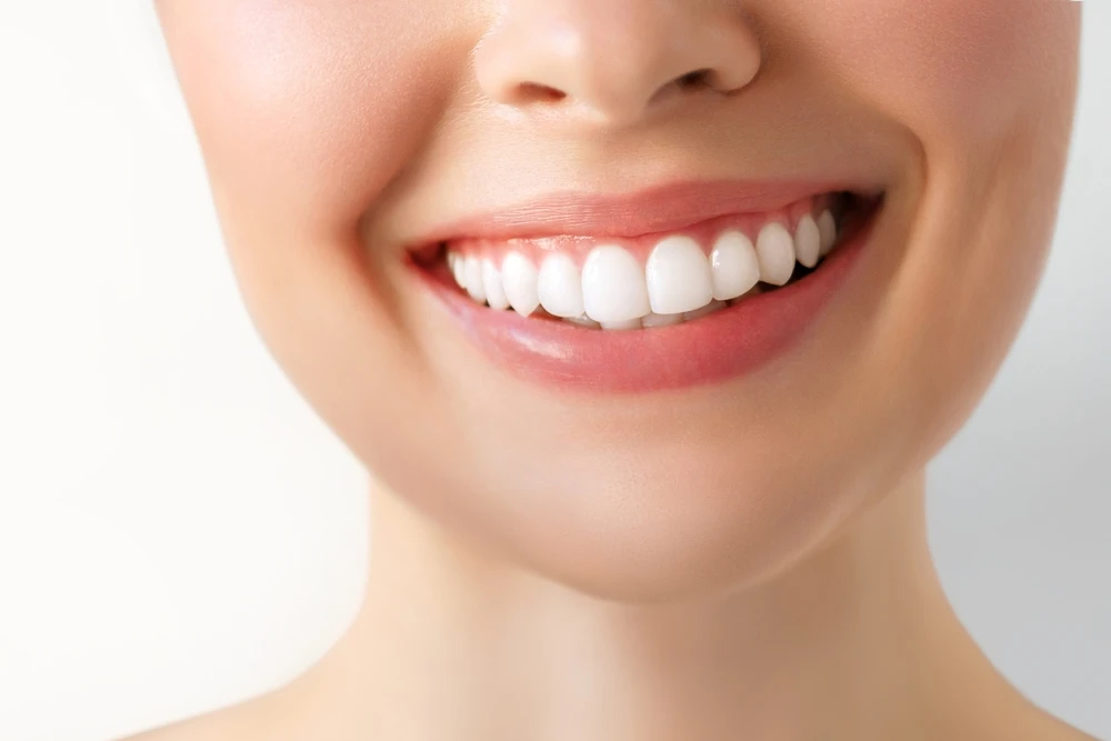 What Miami Residents Should Know About Advanced Dental Implant Technology