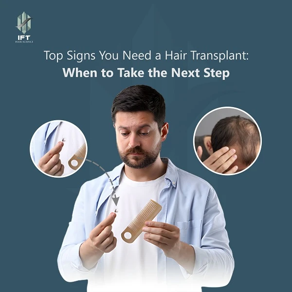 Top Signs You Need a Hair Transplant: When to Take the Next Step