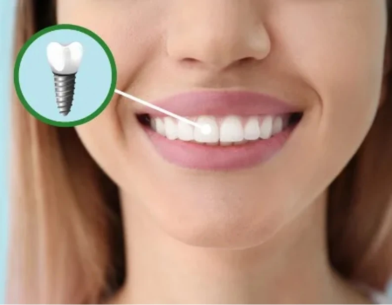 Designing a Healthier, More Confident Smile