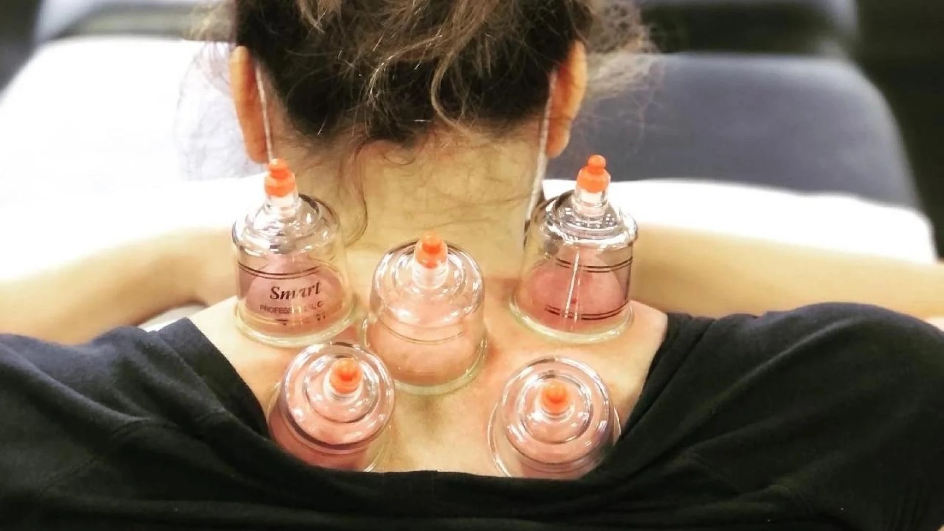 Natural Pain Relief Without Medication: The Role of Hijama Therapy