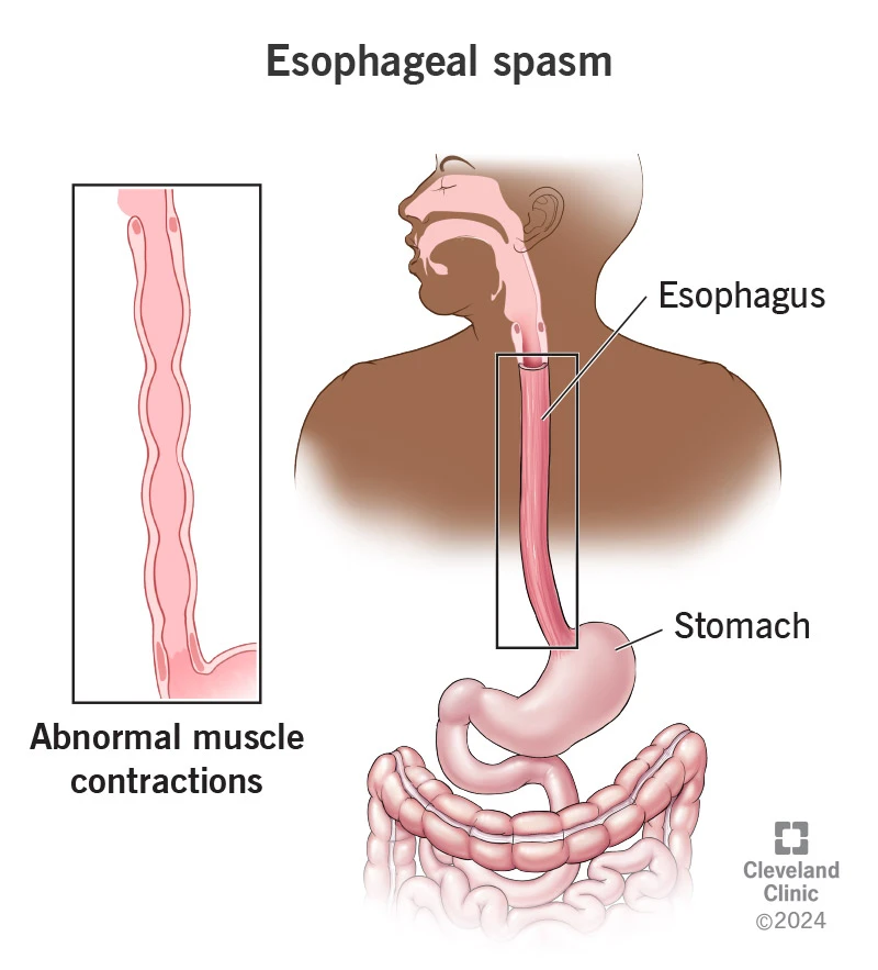 Herbal Supplements for Esophageal Achalasia Treatments