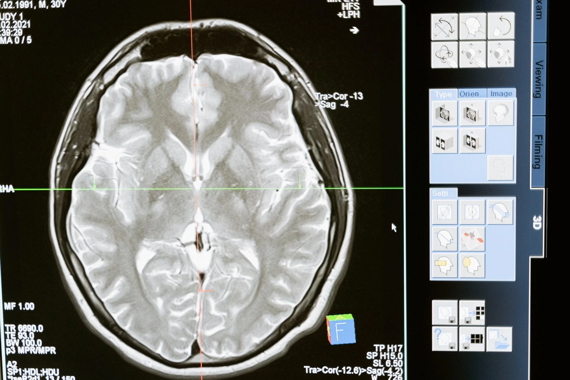 How a Greenville Personal Injury Attorney Proves Fault in Traumatic Brain Injury Cases