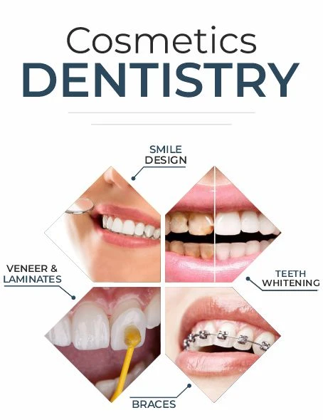 Say Goodbye to Dental Imperfections: Smile Makeover in Panchkula