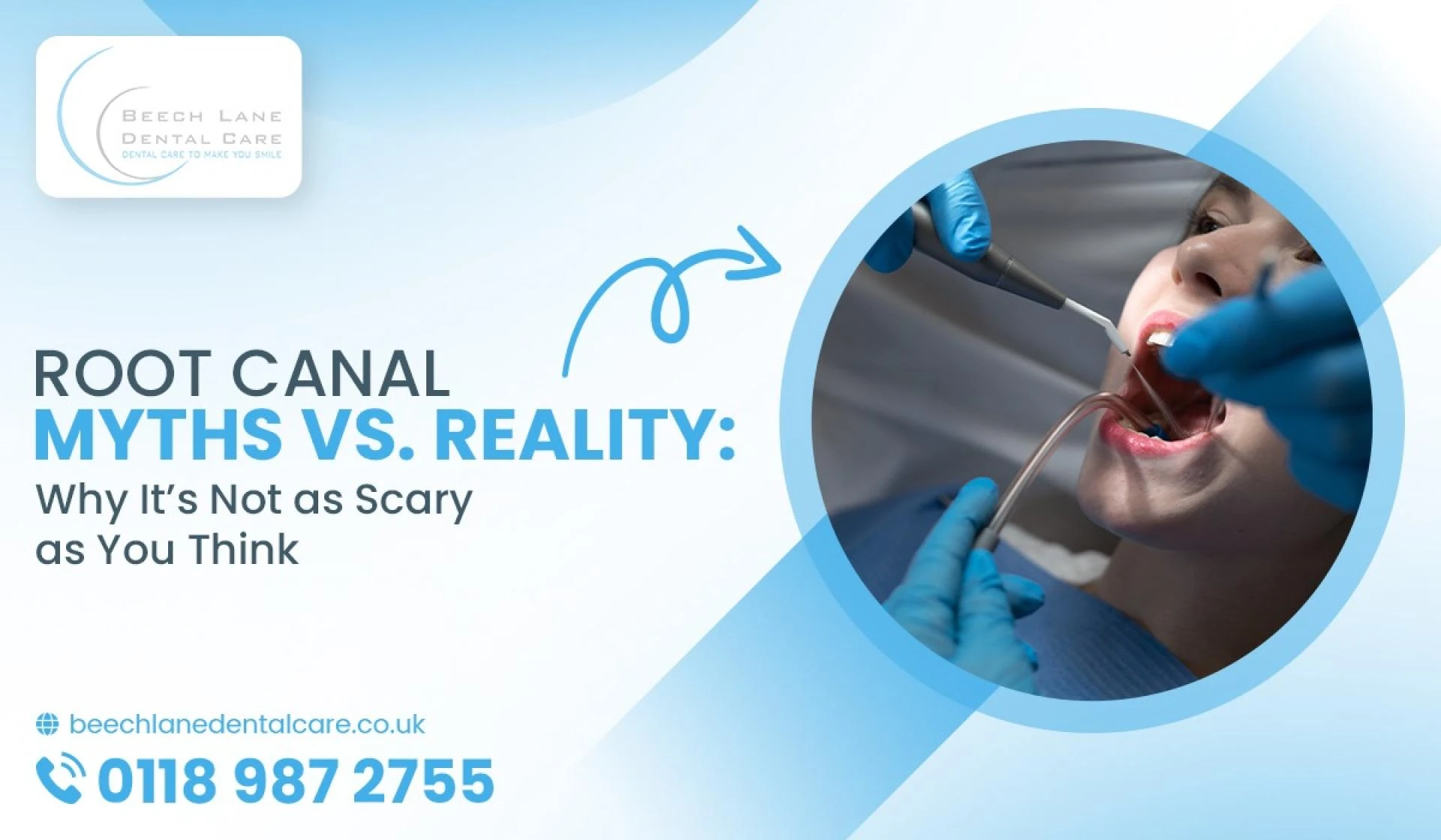 Root Canal Myths vs. Reality: Why It’s Not as Scary as You Think