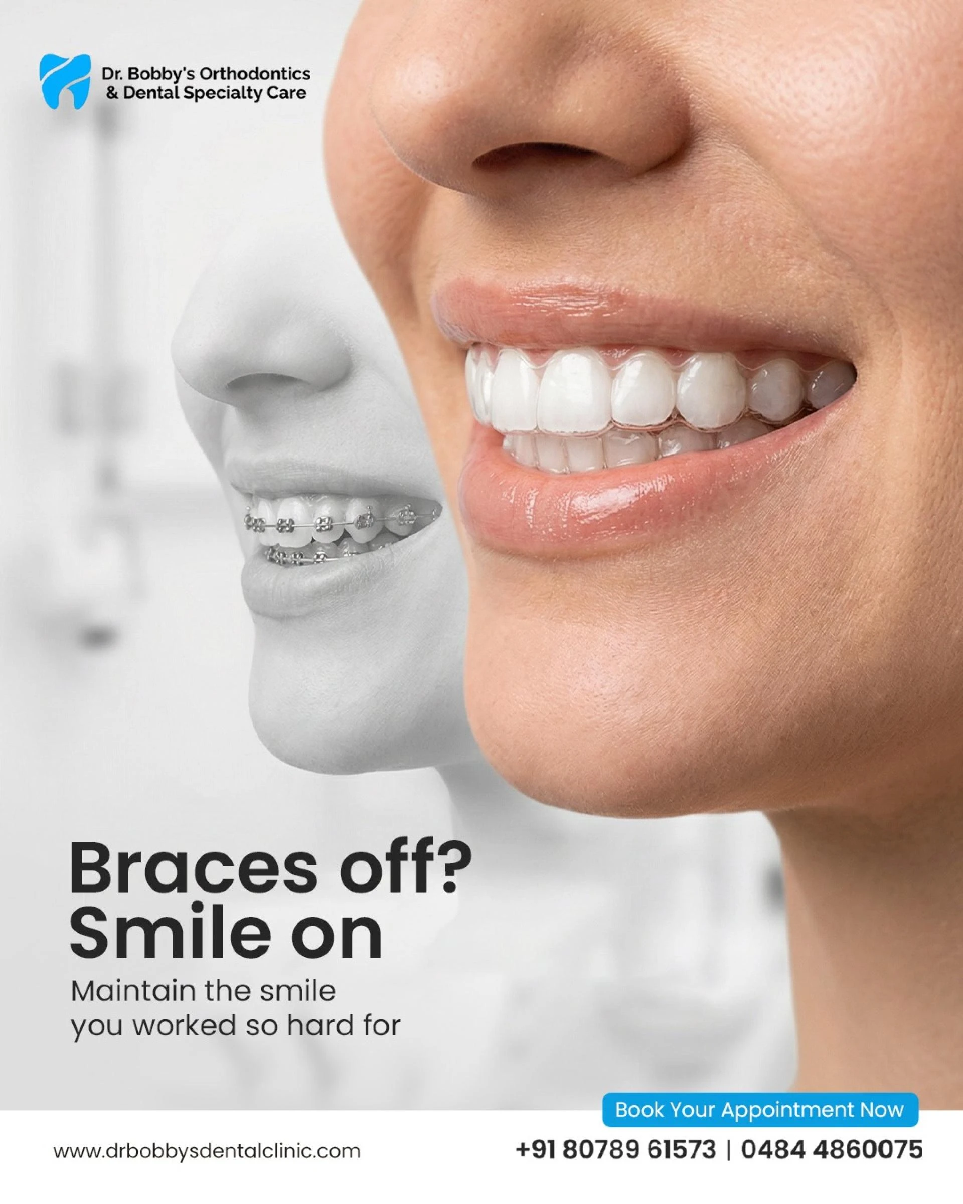 Retainers vs. Clear Aligners: Understanding the Key Differences