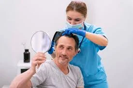Which Hair Restoration Los Angeles Procedure Works Best for Long-Term Results?