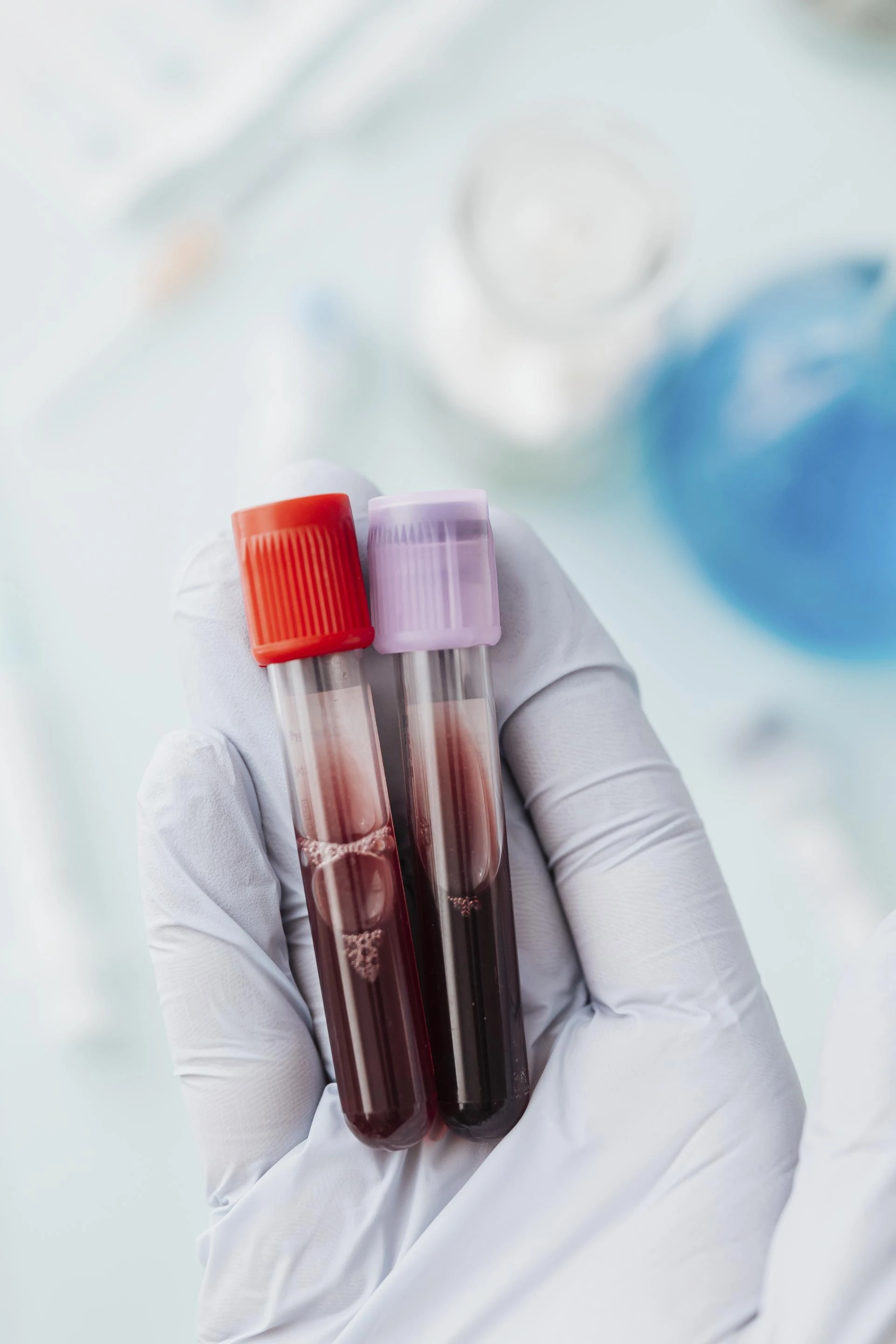 Understanding the hCG Blood Test: A Reliable Way to Confirm Pregnancy