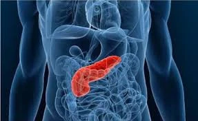 How is Pancreatic Cancer Different from Other Gastrointestinal CancersTitle