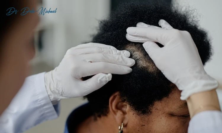 Hair Loss Treatment Dermatologist NYC: Expert Solutions for Healthier Hair