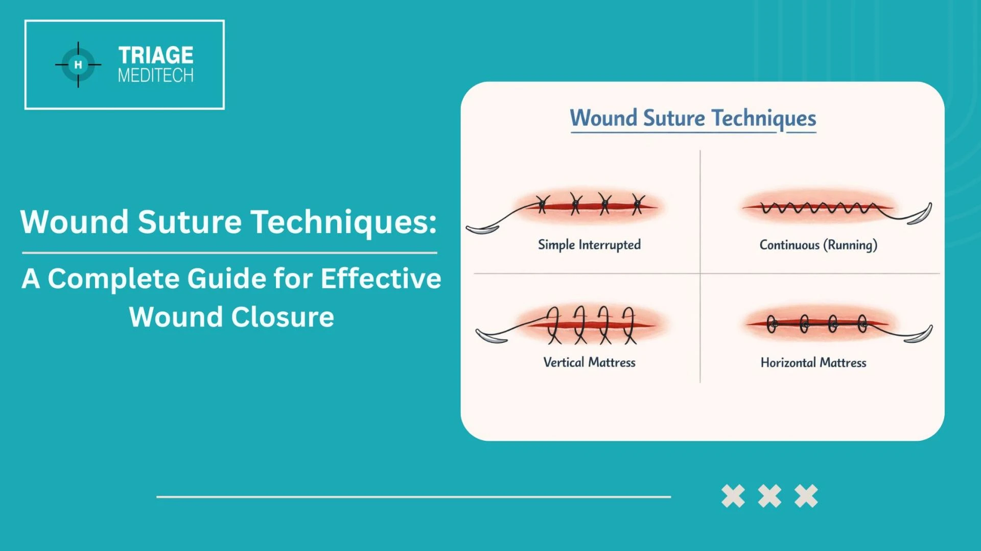 Wound Suture Techniques: A Complete Guide for Effective Wound Closure