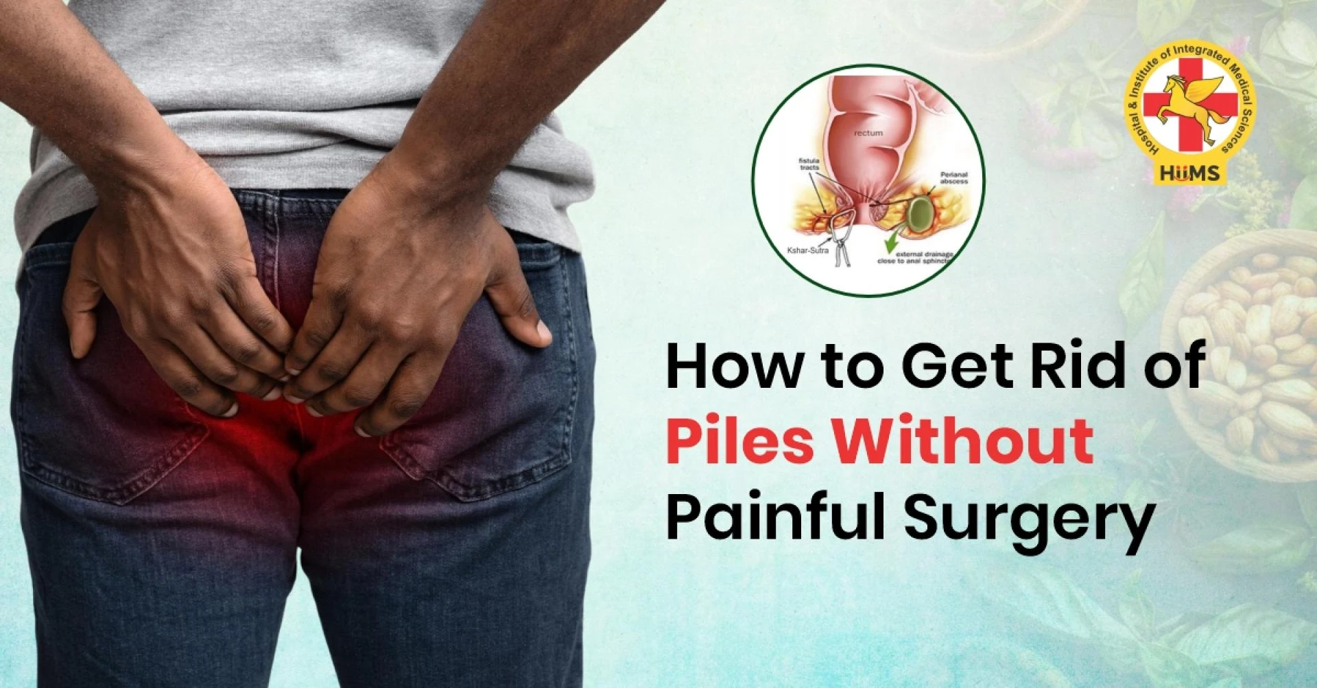Natural Solutions for Piles Without Surgical Treatment