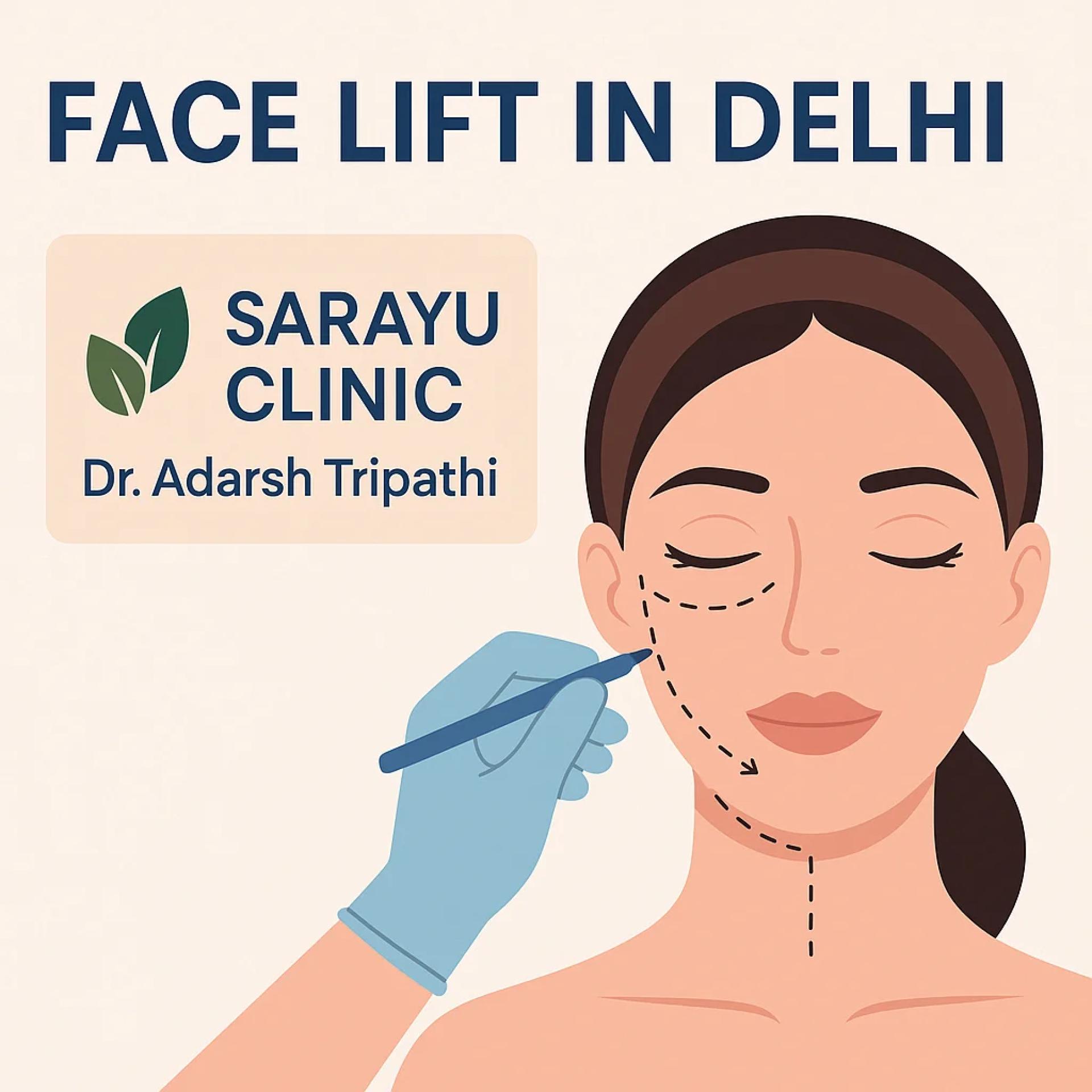Turn Back Time Naturally: Everything You Need to Know About Facelift Surgery in Chanakyapuri