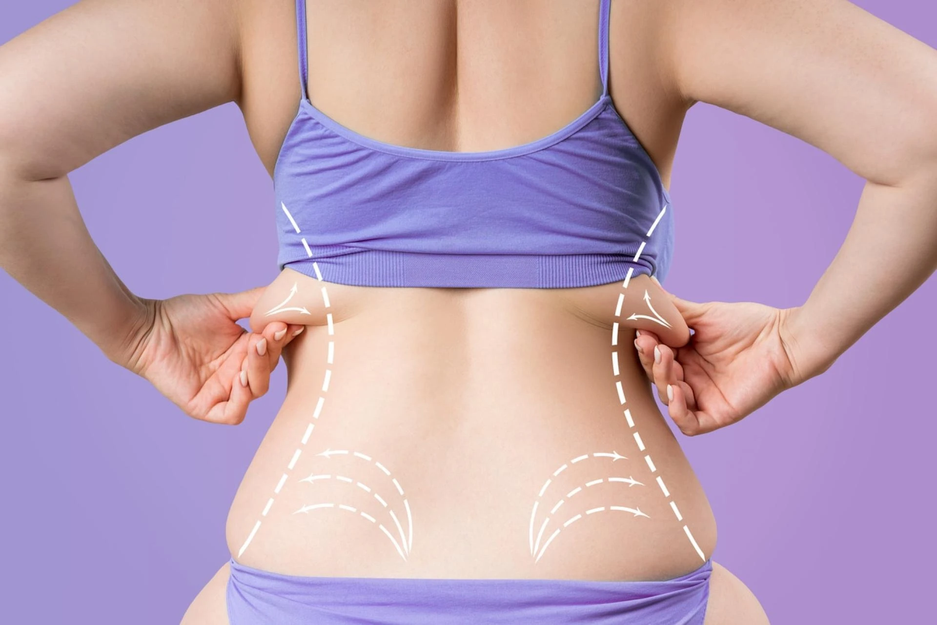 Is Vaser 4D Liposuction the Secret to Defined Abs and Smooth Curves Naturally