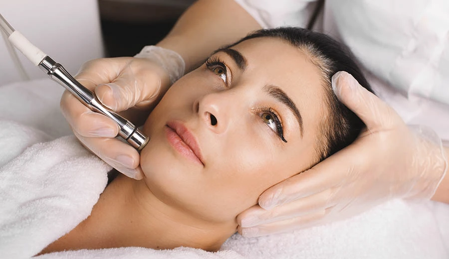 What Areas Can Microneedling Improve?