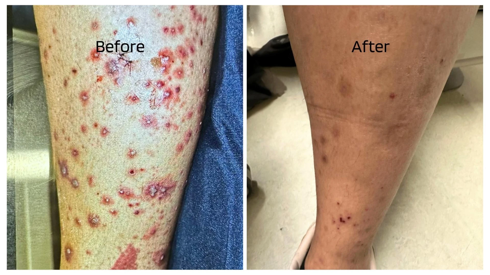 Gentle Cream Solutions for Sensitive and Rosacea Skin