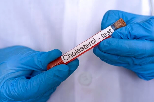 Why a Cholesterol Test Is Important for Heart Health