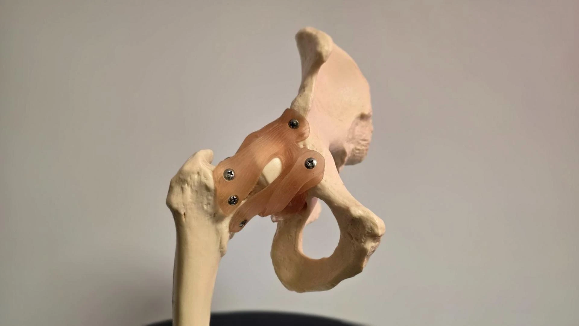 Simple Hip Exercises to Improve Flexibility, Strength and Reduce Pain