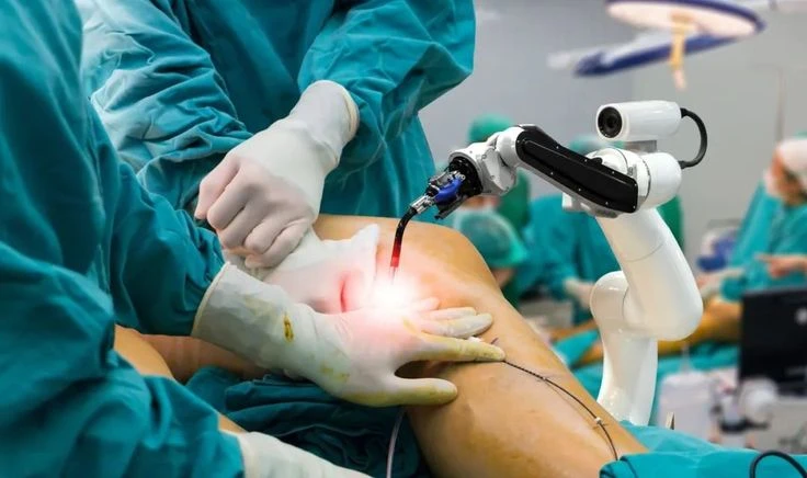 Robotic Knee Replacement Surgery: Step-by-Step Process and Long-Term Results