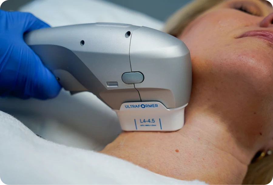 Is HIFU Treatment a Revolutionary Choice for Youthful Skin Look