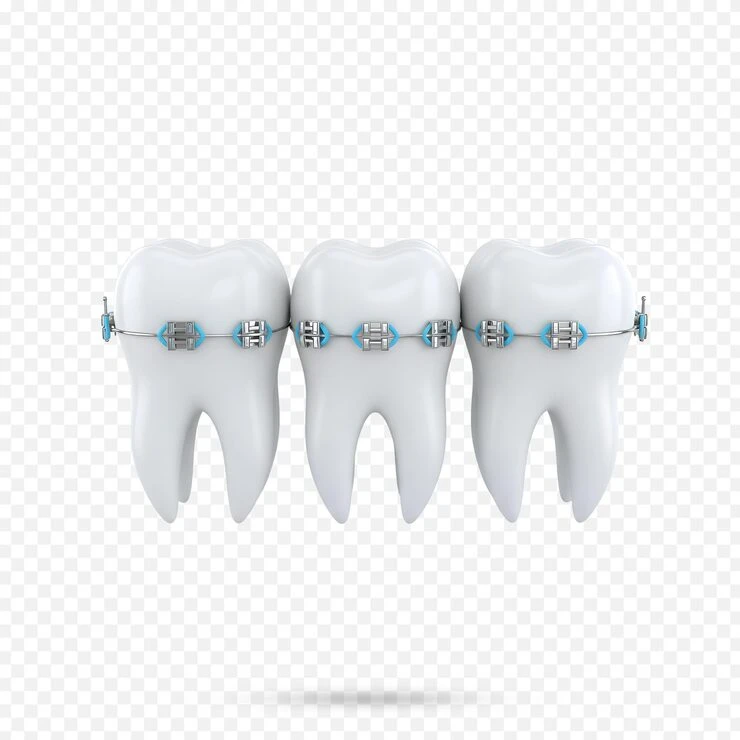 Kids’ Braces in Suffolk: Where to Go and What to Expect