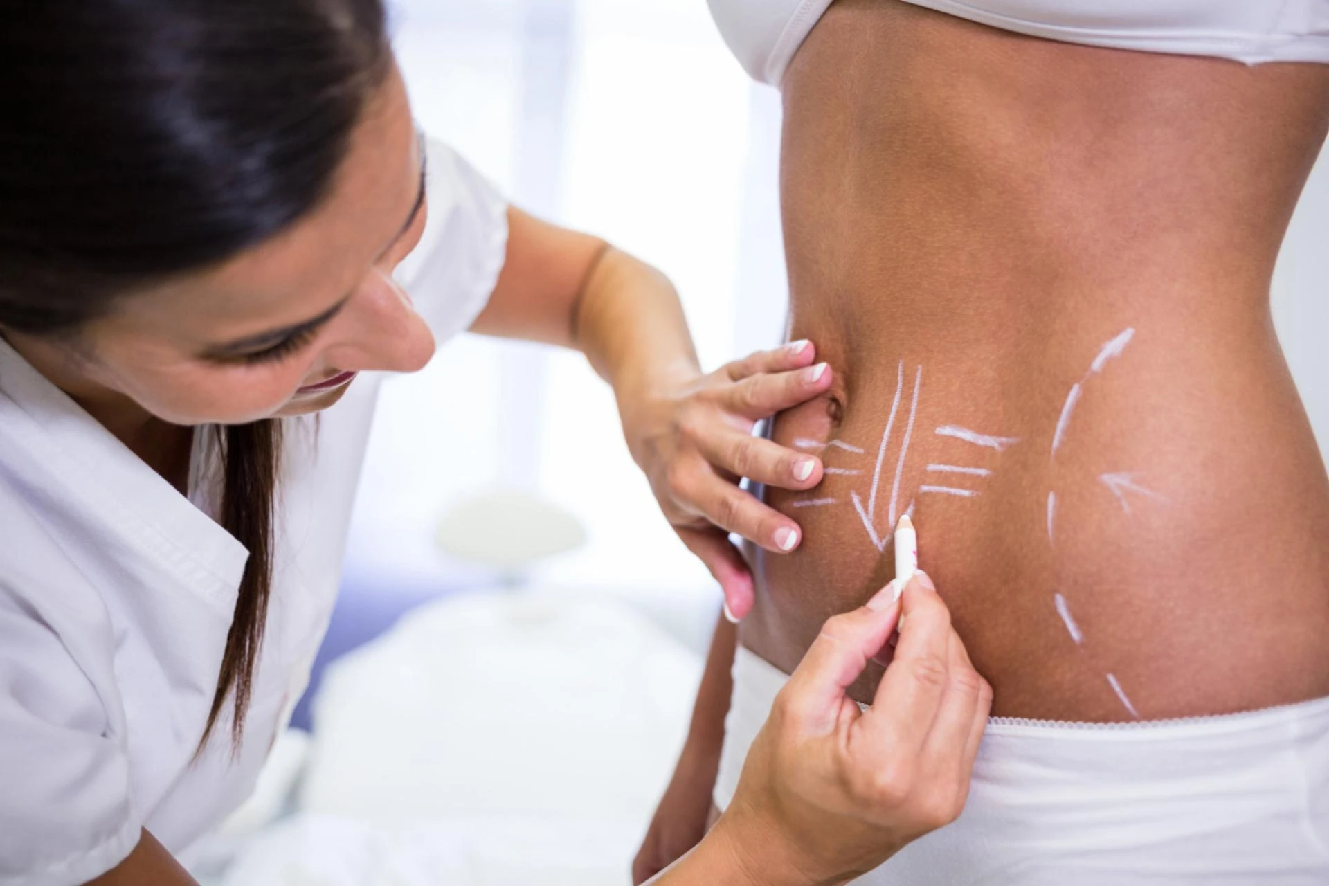 Is Liposuction Covered Under Insurance?