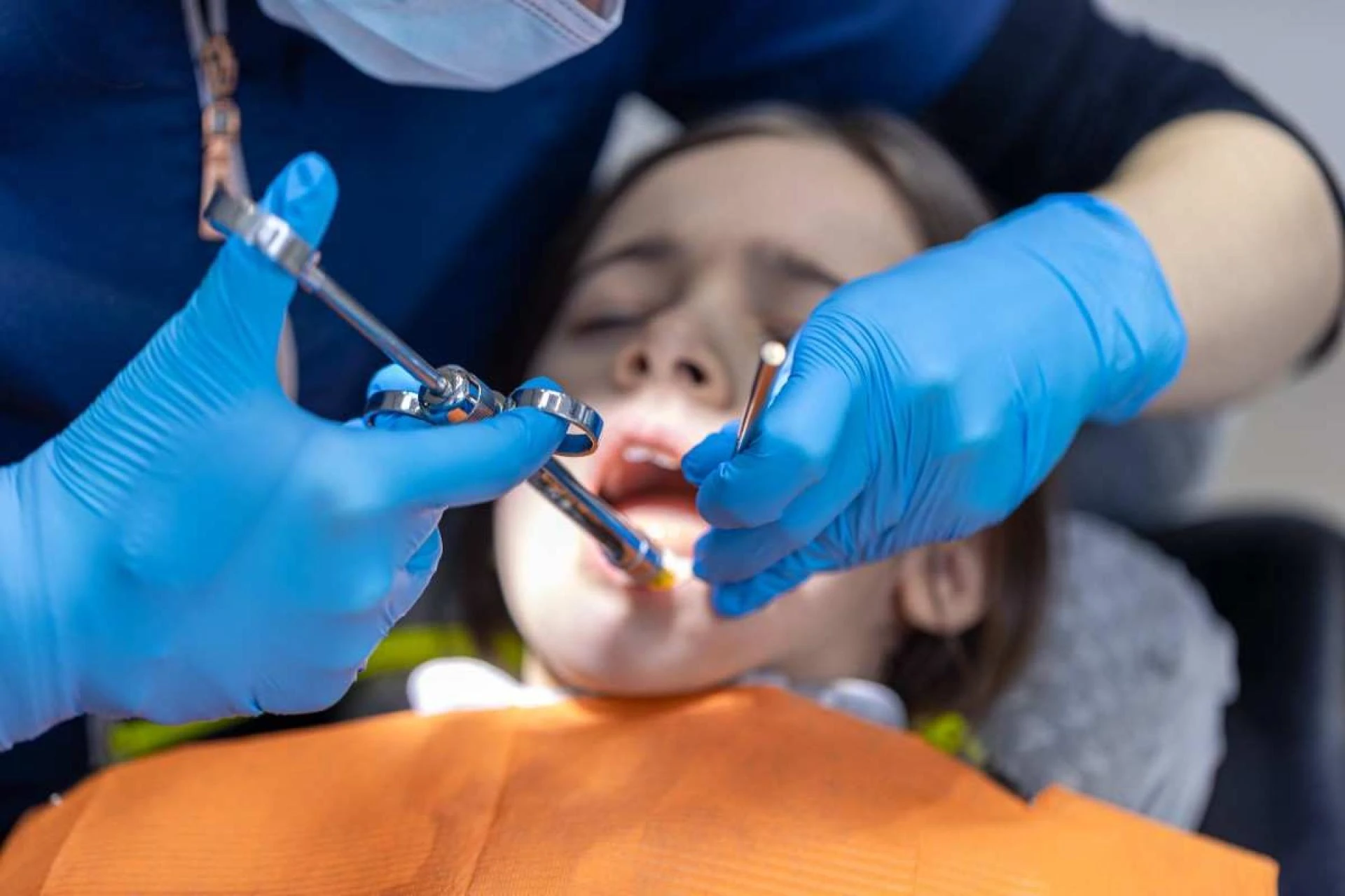 Top Signs You Might Need a Tooth Extraction