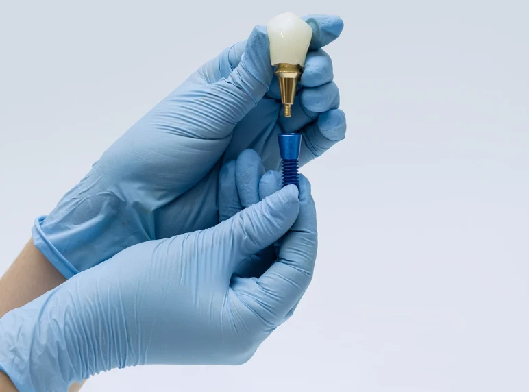 What No One Tells You About Dental Implant Recovery