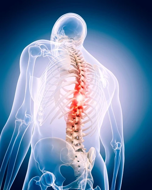 Best Spine Surgery Hospital in India- Ashish Joint Replacement Care
