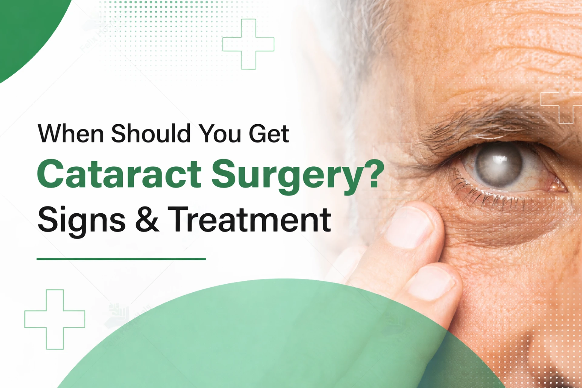 When Should You Get Cataract Surgery? Signs & Treatment