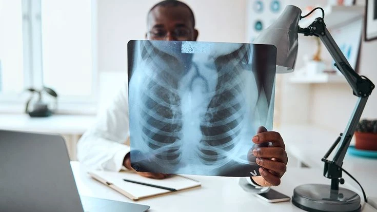 Understanding Radiology: A Complete Guide to Medical Imaging