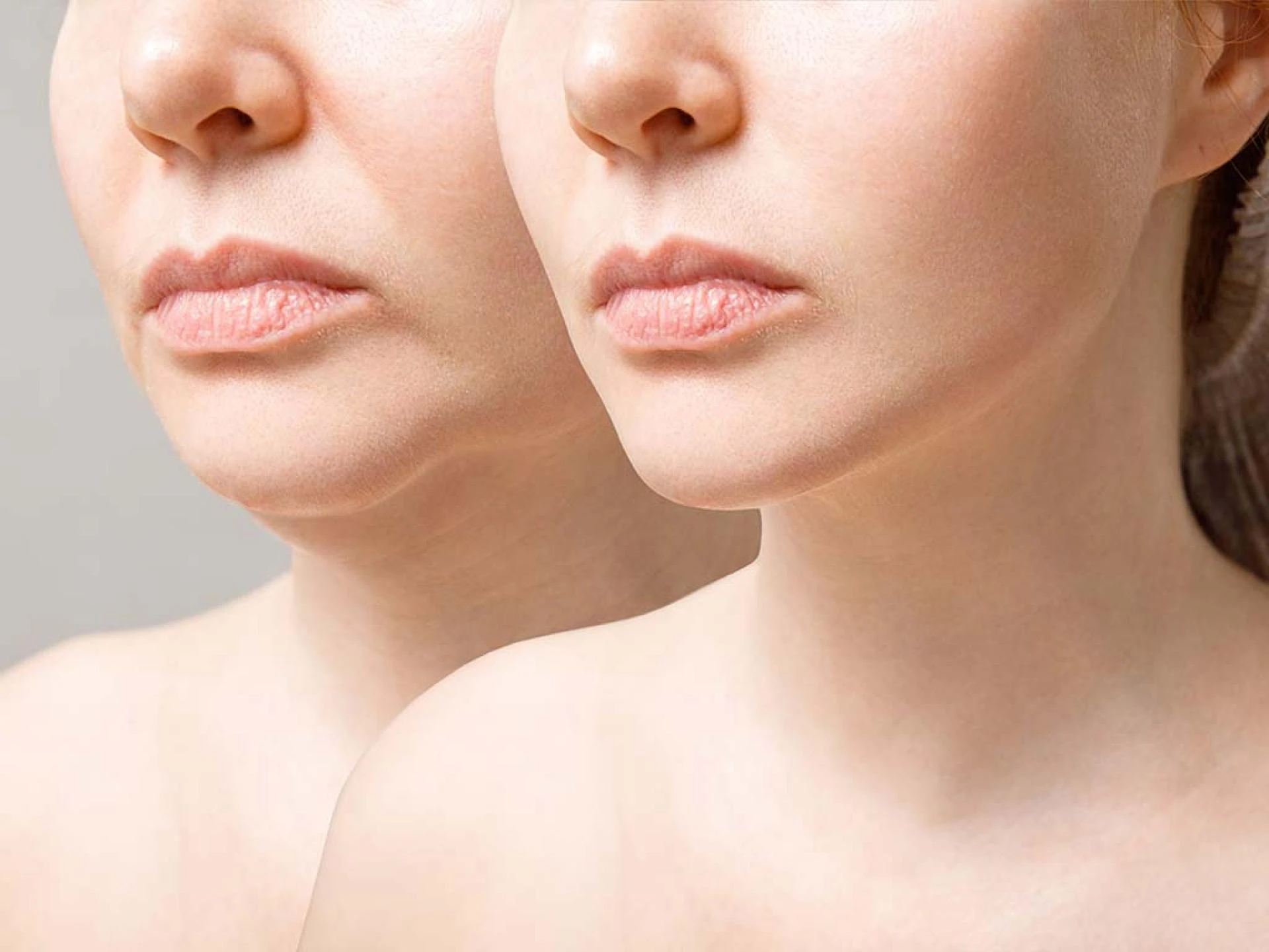 Empowering Yourself: When to Walk Away from a Surgical Consultation