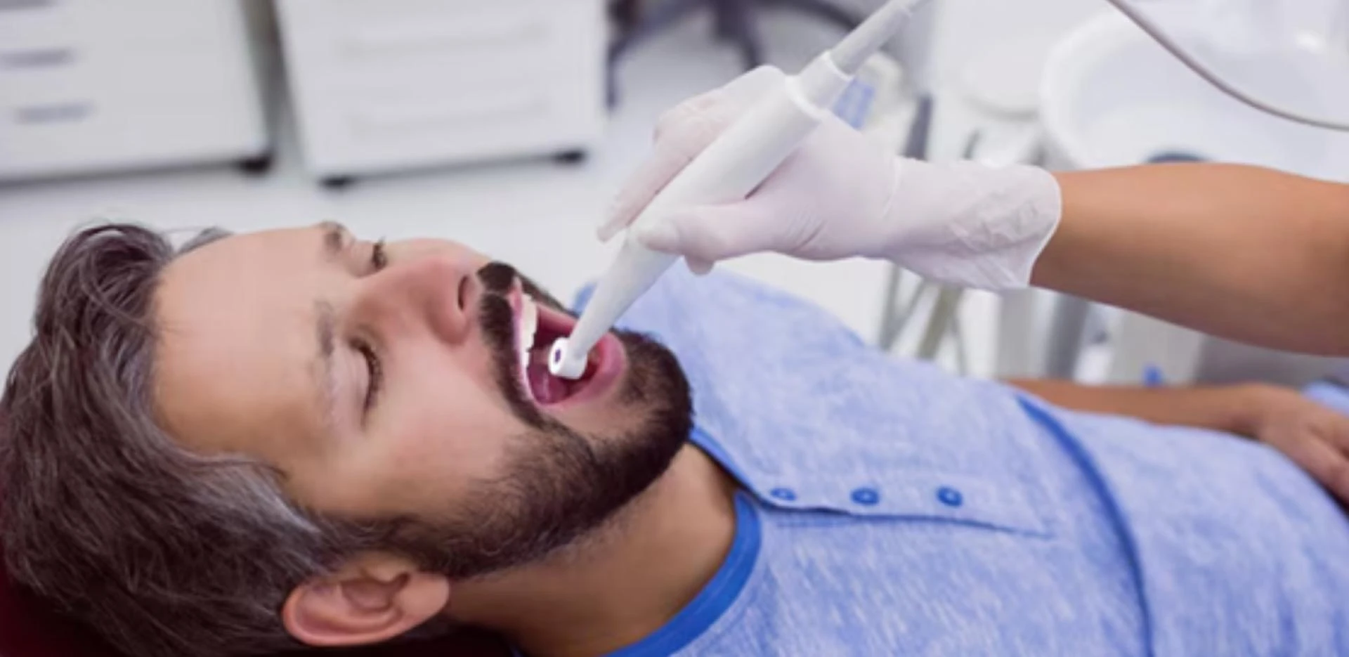 Top Tips for Maintaining Your Tooth Filling