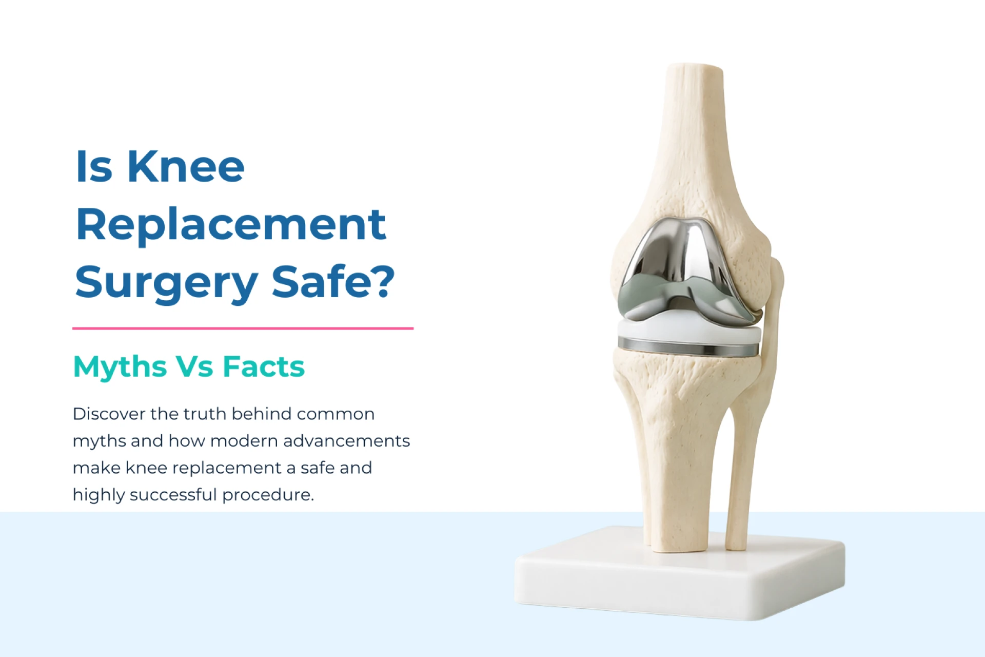 Is Knee Replacement Surgery Safe? Myths vs Facts