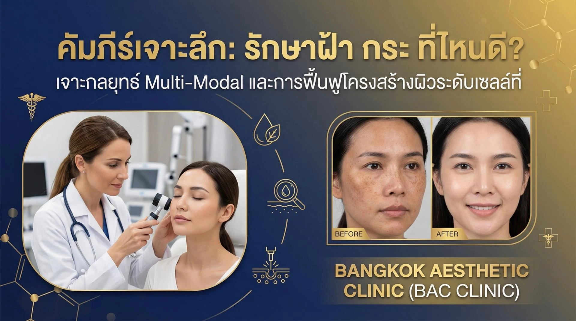 The Definitive Guide to Advanced Acne Scar Revision in Bangkok