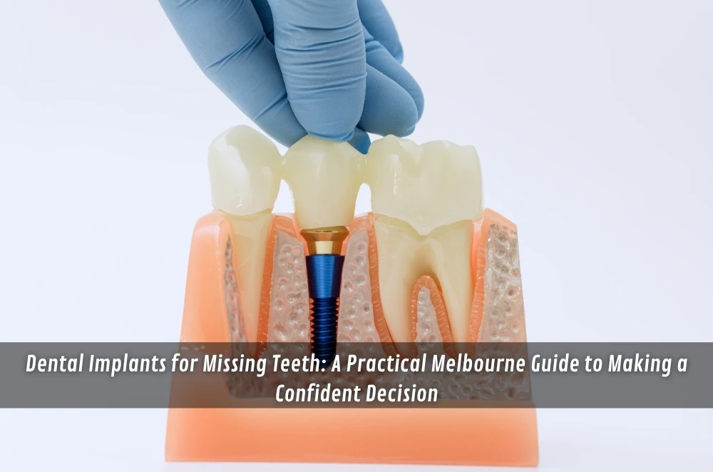 Dental Implants for Missing Teeth: A Practical Melbourne Guide to Making a Confident Decision