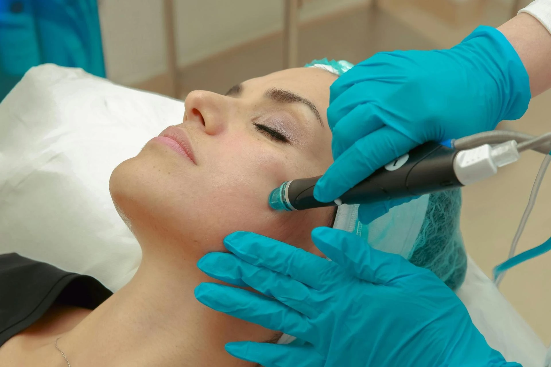 Best Treatment For Scars On Face Johor Bahru