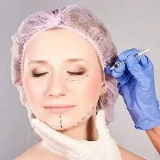 How does RF skin tightening work at Medixo Aesthetic Clinic?