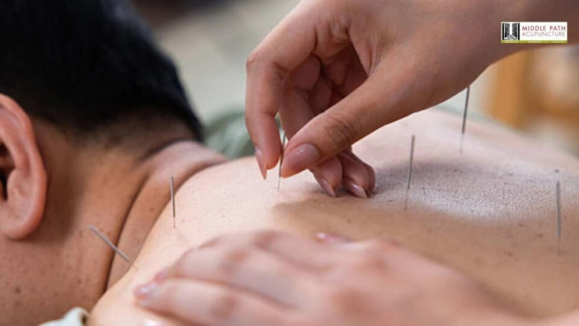 Could Myofascial Therapy Be a Natural Alternative to Pain Medication?