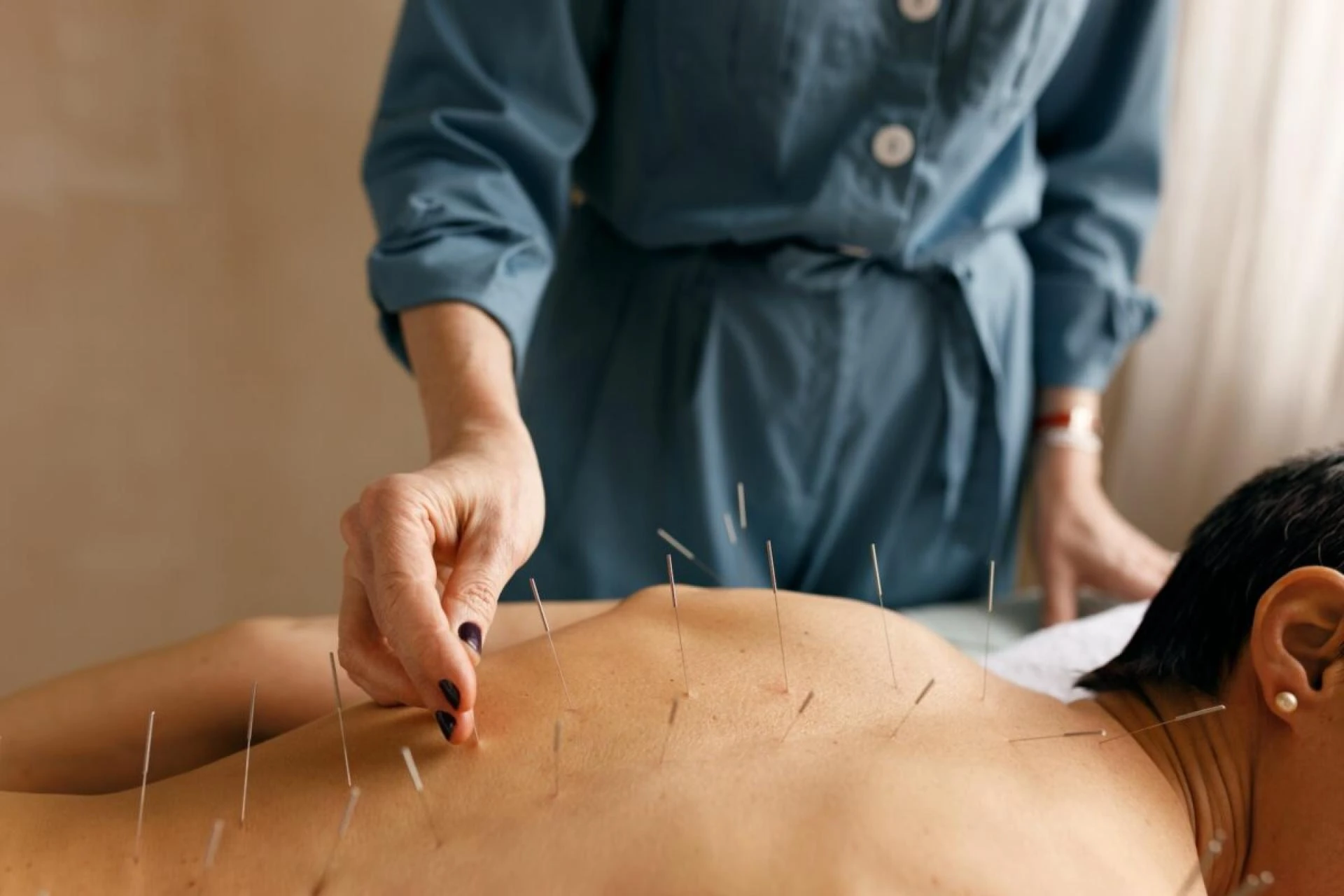 Benefits of Choosing Acupuncture for Pain Management in Philadelphia