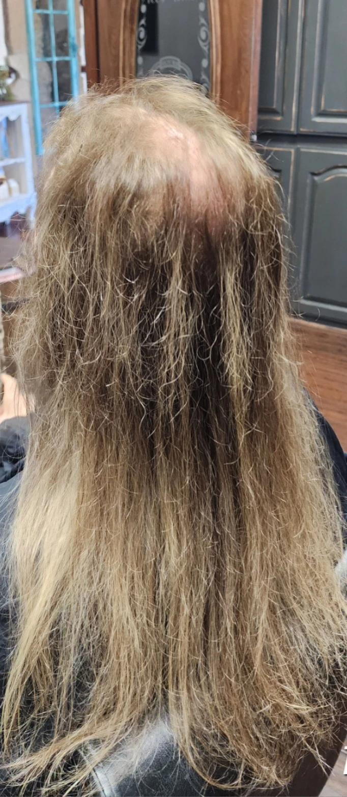 Modern Non-Wig Options for Natural Hair Coverage in Southlake