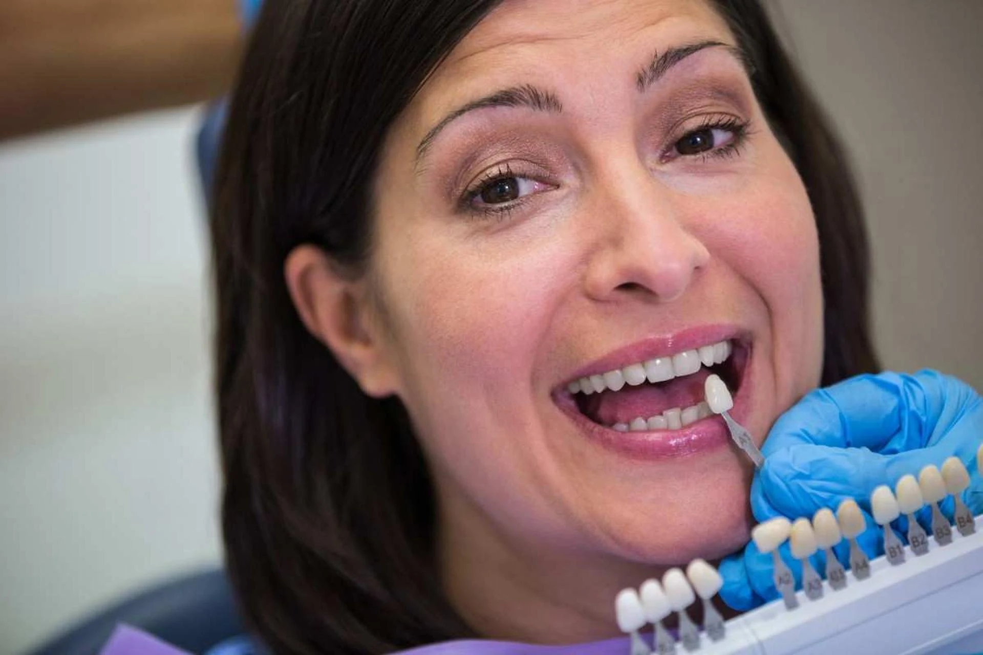 What Is Crown Lengthening? A Quick Guide for Beginners
