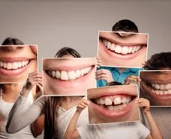 Veneers in Turkey: Cost Comparison and Smile Transformation for UK Patients 