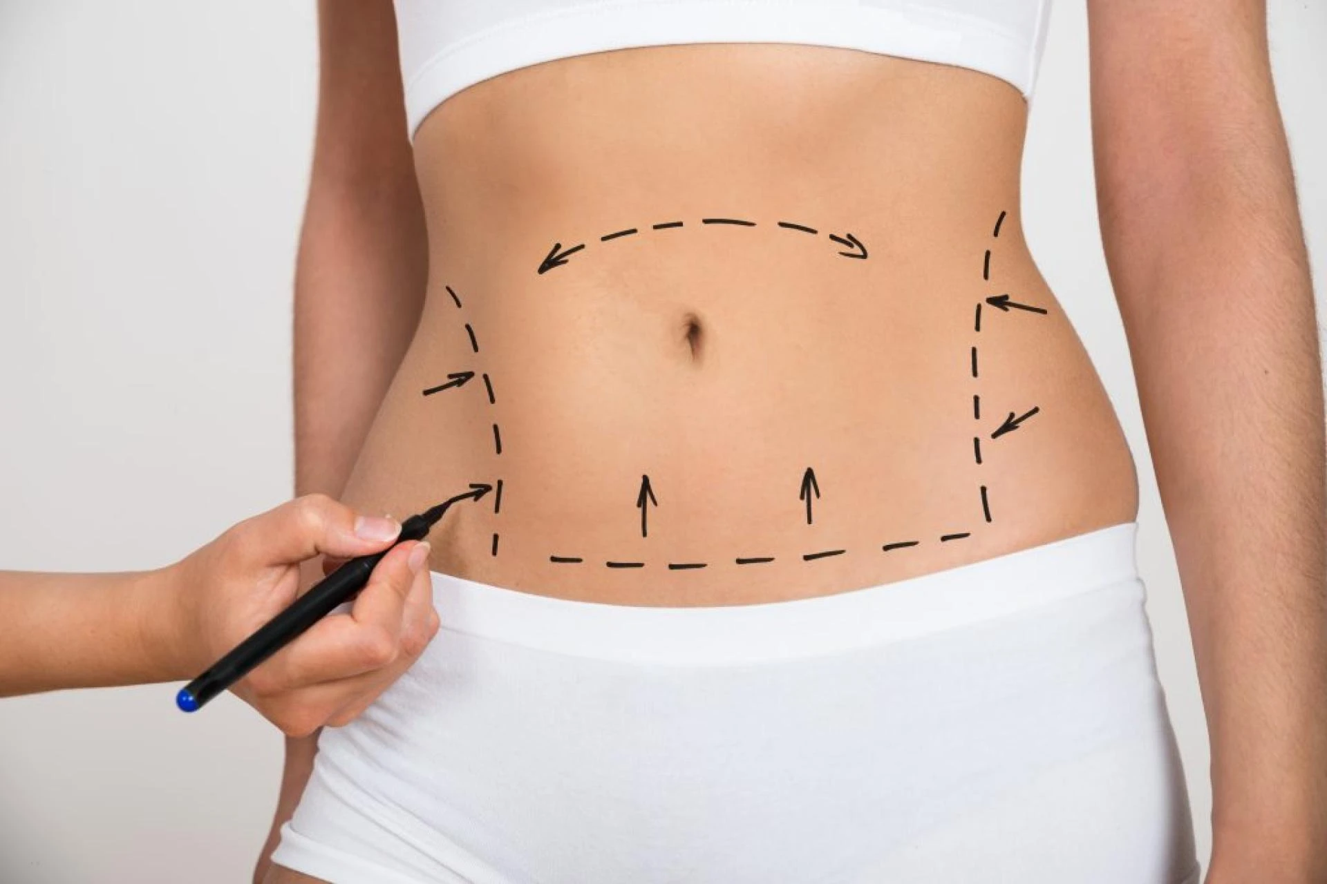 Liposuction in Islamabad – Smooth Shape Post Title
