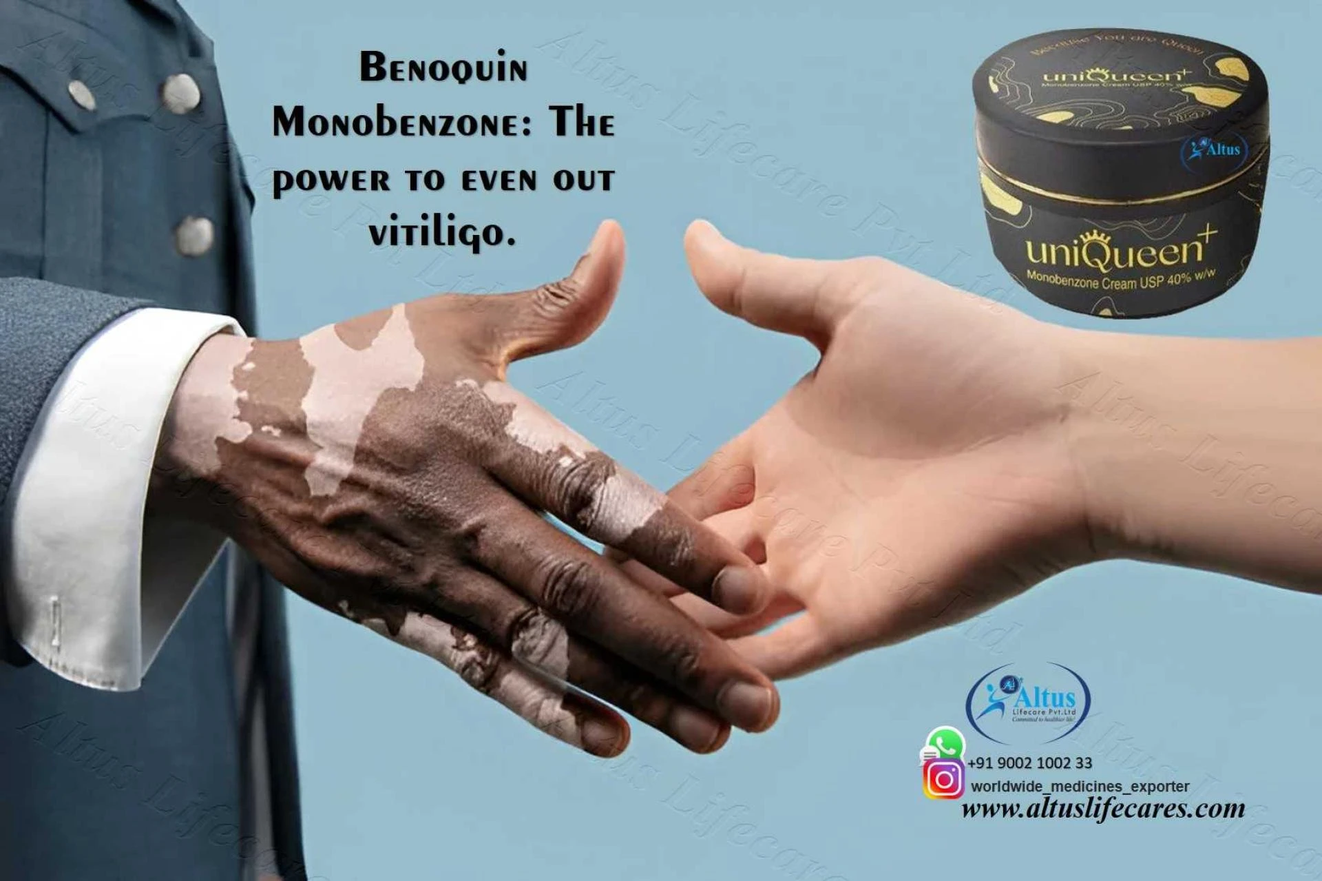 Uniqueen 40 Cream: Powerful Help for Severe Vitiligo Skin