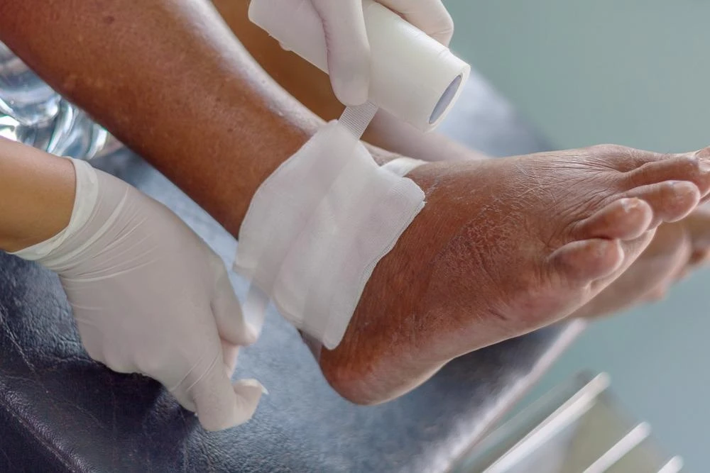 Chronic Wound Management at Home in Michigan: A Practical Plan for Families